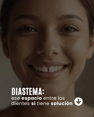 Publicación: diastema, ese espacio entre los dientes sí tiene solución