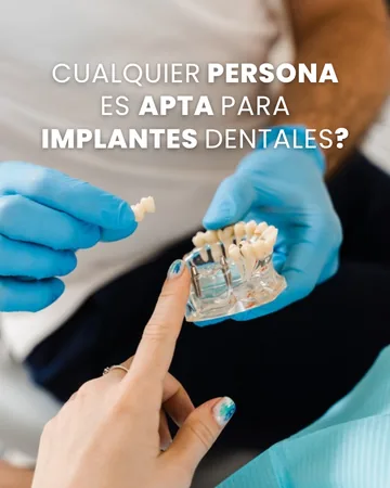 Publicación: ¿cualquier persona es apta para implantes dentales?