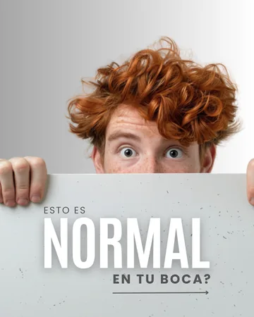 Portada de carrusel: ¿esto es normal en tu boca?