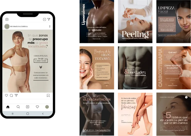 Publicación en móvil y nueve piezas del feed de MA Medicina Estética